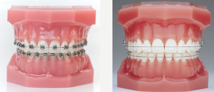 ortho5